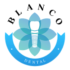 Стоматология «Бланко» — квалифицированая имплантация